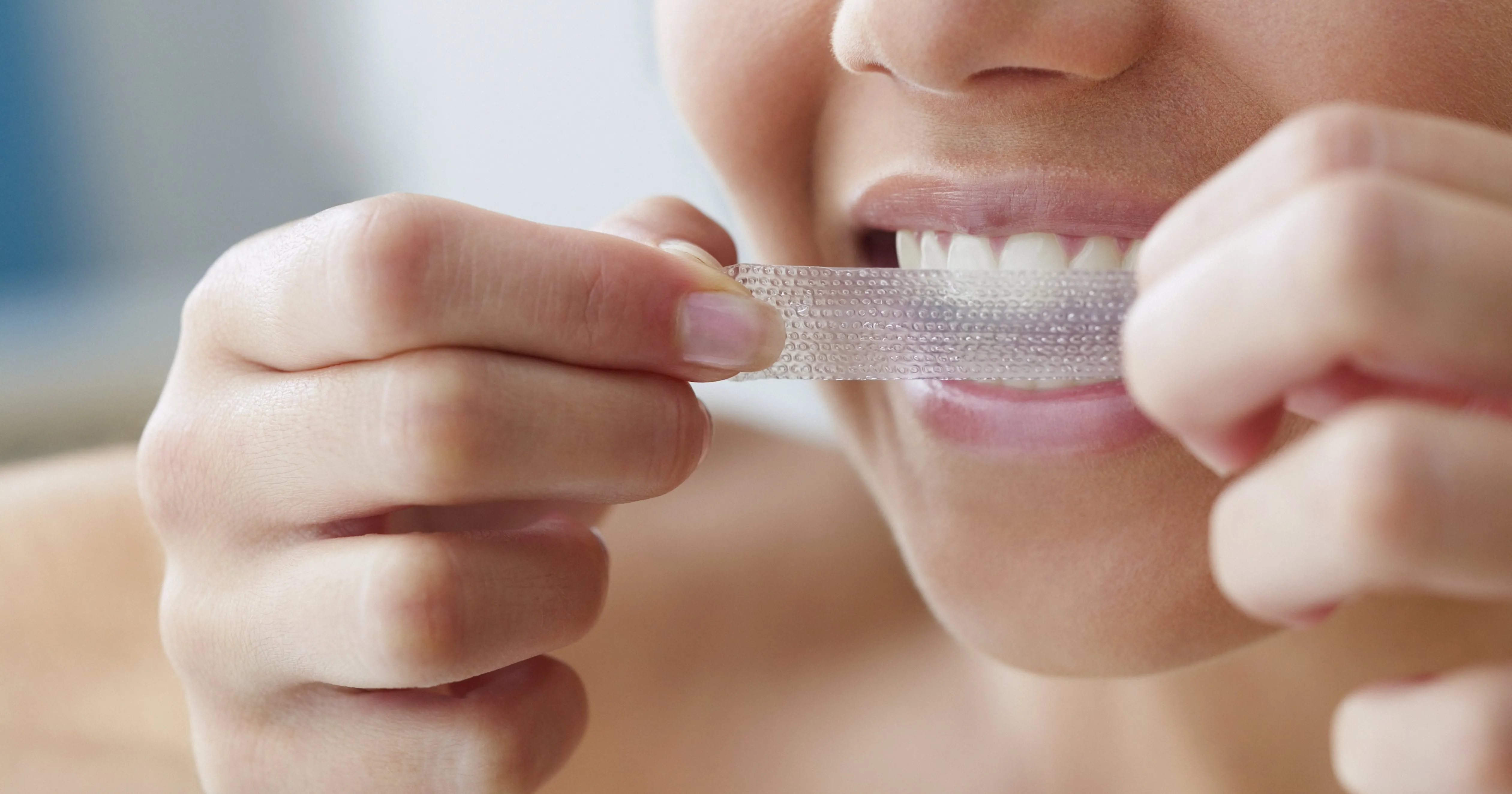 32563 fluoride treatment