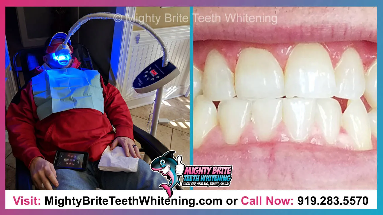 32564 brite dental regular checkups
