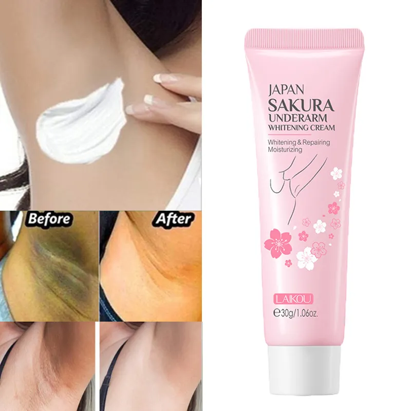 32573 underarm discoloration