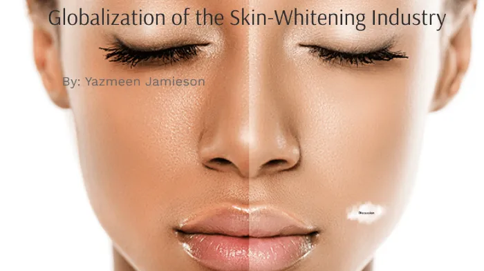 32579 skin whitening treatments