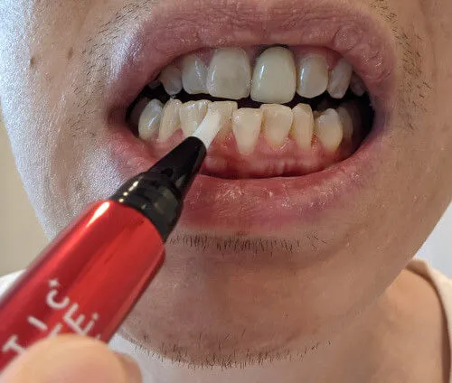 32581 mouthwash usage