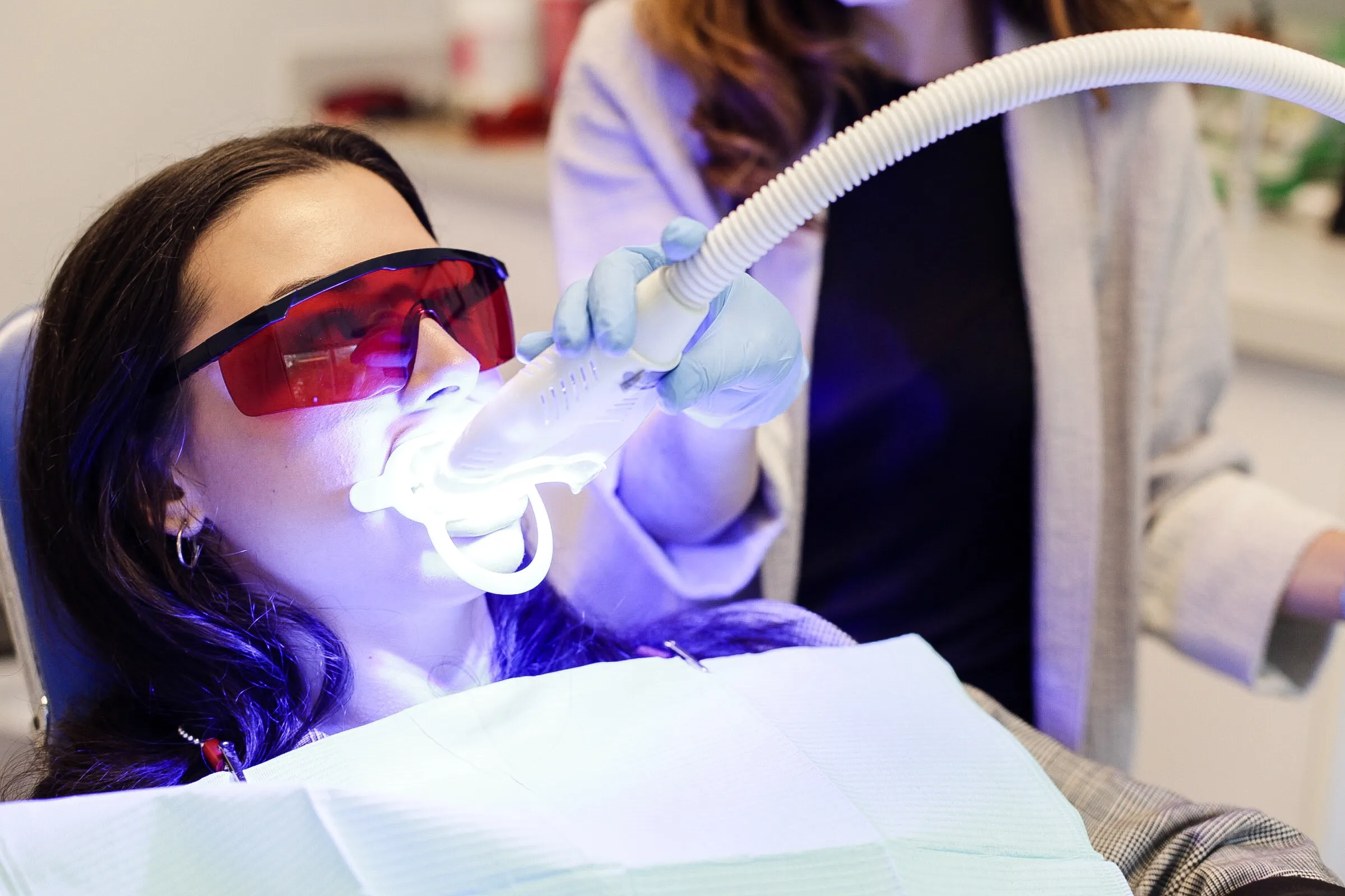 32594 at home teeth whitening kits