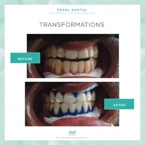 32594 smiling with confidence