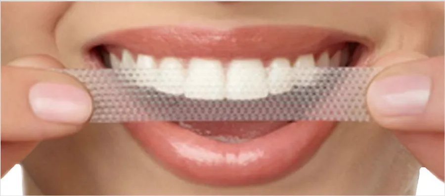 32594 teeth whitening treatment options