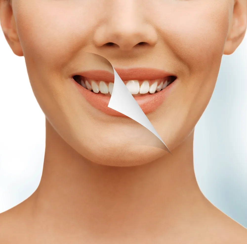 32597 teeth whitening treatment options