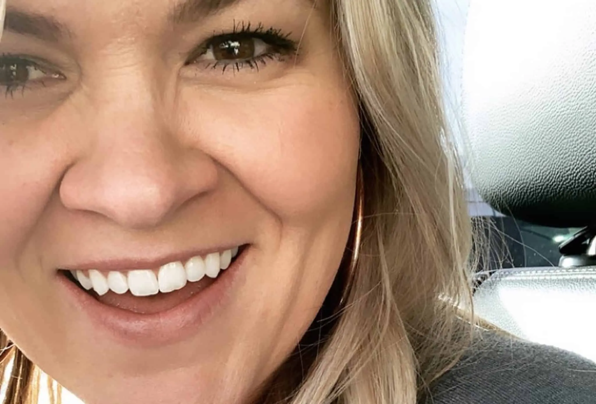 32598 gran canaria dental tourism