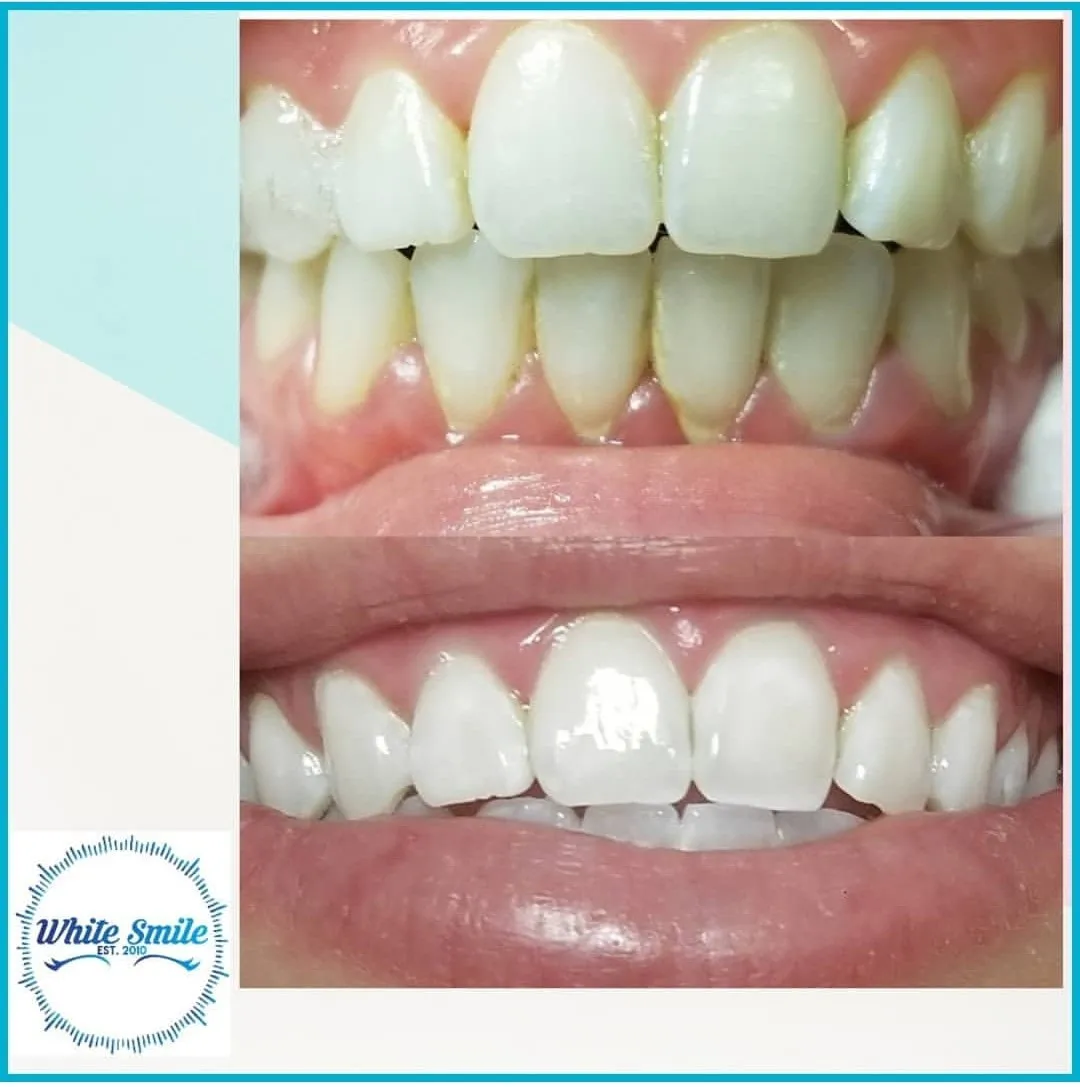 32614 healthy foods teeth