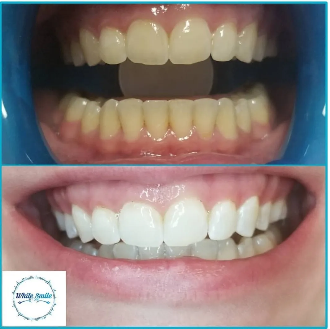 32614 montreal skyline