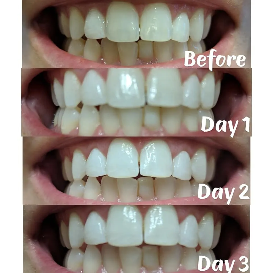 32626 crest 3d strips teeth