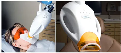 32629 zoom teeth whitening logo typography examples