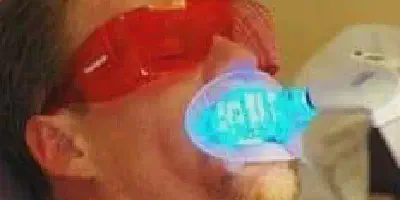 /img/32630-laser-teeth-whitening-manhattan-7.webp