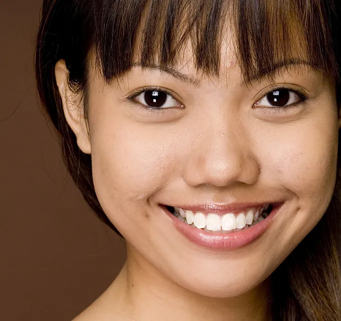 32631 teeth whitening maintenance