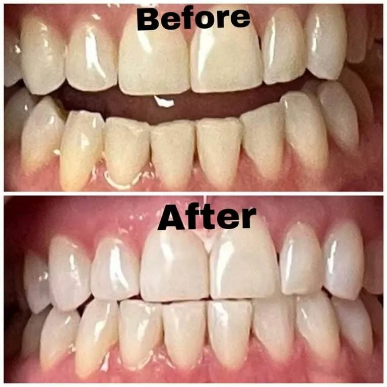 32639 whitening toothpaste